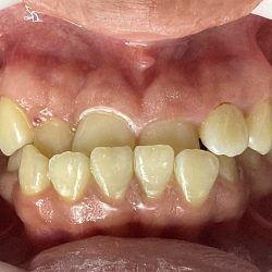 Orthodentalimplant