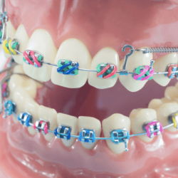 Orthosmad