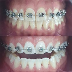 Pantoja Dental Clinic