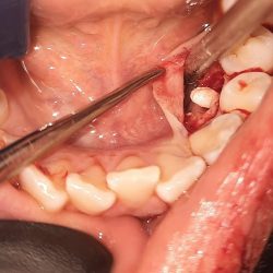 Patini Dental