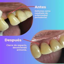 Patricia Vicente Hurtado Dds Los Algodones Y Ahora También En Mexicali, B.c. Implants, Aesthetic Dental