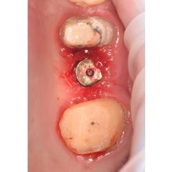 Periodoncista Mariela Gumar