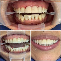Pro Dental Consultorio Dental