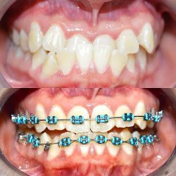 Promodent Consultorio Dental
