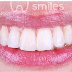 Prorthodontics Dental Group