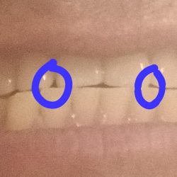 Prosonrisas San Cristóbal