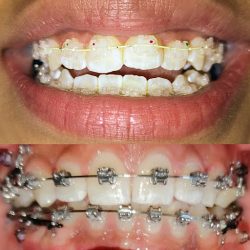Rehabilitartedental Tlaxcoapan