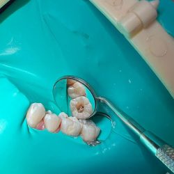 Remedental