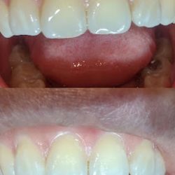 Reyes Dental