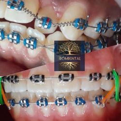 Romdental Maravatio
