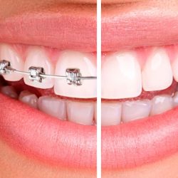 Rosarito Dental Group