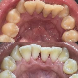 Rosenber Dental (clínica Dental)