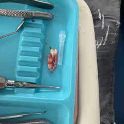 Salud Dental