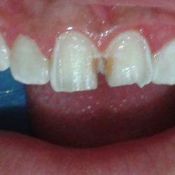 Salud Dental