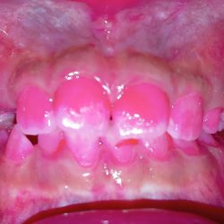 Salud Dental San Mateo