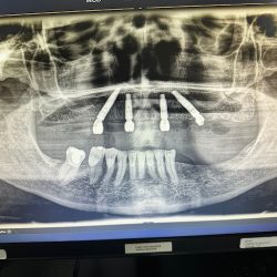 Samaritan Dental