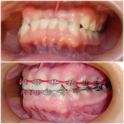 Sana - Dentista / Ortodoncia
