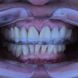 Saphire Dental Care - Cuautitlán Izcalli