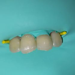 Sernadental