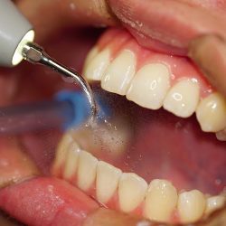 Siso Dent