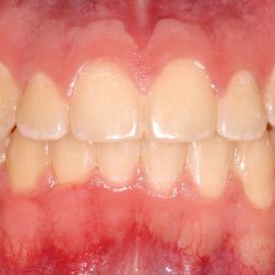 Smart Smile - Clínica Dental