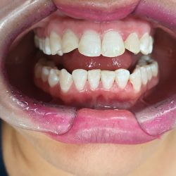Smile Dent