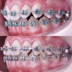 Smile Dental