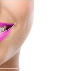 Smile Dental