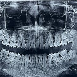 Smile Dental Studio Suc. Texcoco