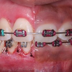 Smilingum Dentista