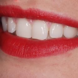 Soin Dental