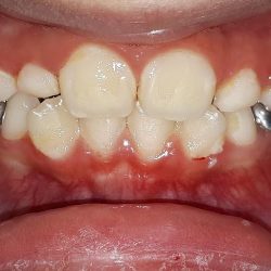 Sonríe Especialidades Dentales