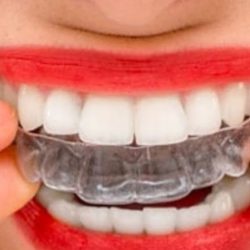 Sonrie Siempre Dentistas