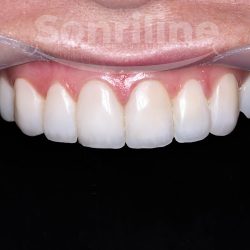 Sonriline