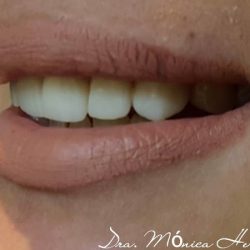 Spa Dental Reynosa