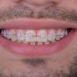 Spacio Dental