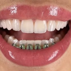 Tecnodental