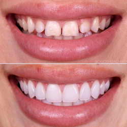 Tijuana Clinic For Cosmetic Dentistry