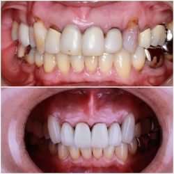 Tj Endodontics