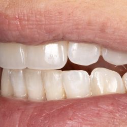 Tooth Core, Odontología Restauradora Y Ortodoncia.