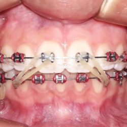 Valdent Clinica De Ortodoncia Y Ortopedia Maxilar