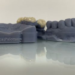 Veronica Palomares Ramírez Cirujano Dentista