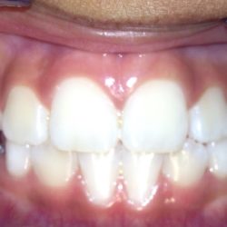 Vi Dental