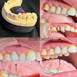 Villa Dental Tlax