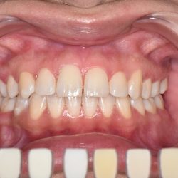 Vitadent Clínica Dental