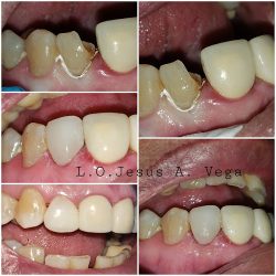 Vj Clínica Dental (dr. Jesús Alberto)