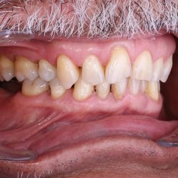 Zental Odontología - Cumbres - Clínica Dental Monterrey