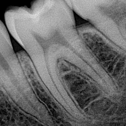 Zohni Dental.